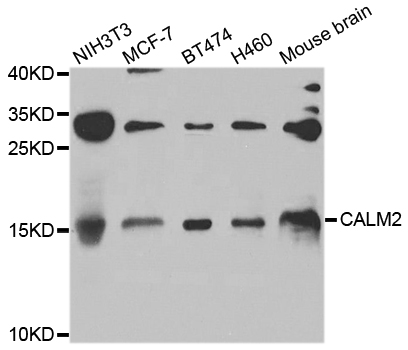 CALM2 / Calmodulin 2 Antibody - Western blot analysis of extracts of various cell lines.
