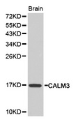 CALM3 / Calmodulin 3 Antibody - Western blot analysis of extracts of mouse brain, using CALM3 antibody. The secondary antibody used was an HRP Goat Anti-Rabbit IgG (H+L) at 1:10000 dilution. Lysates were loaded 25ug per lane and 3% nonfat dry milk in TBST was used for blocking.