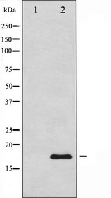 CALM3 / Calmodulin 3 Antibody - Western blot analysis of Calmodulin expression in NIH-3T3 whole cells lysates. The lane on the left is treated with the antigen-specific peptide.