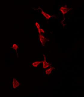 CALM3 / Calmodulin 3 Antibody - Staining HeLa cells by IF/ICC. The samples were fixed with PFA and permeabilized in 0.1% Triton X-100, then blocked in 10% serum for 45 min at 25°C. The primary antibody was diluted at 1:200 and incubated with the sample for 1 hour at 37°C. An Alexa Fluor 594 conjugated goat anti-rabbit IgG (H+L) Ab, diluted at 1/600, was used as the secondary antibody.