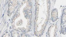 CALM3 / Calmodulin 3 Antibody - 1:100 staining human prostate tissue by IHC-P. The sample was formaldehyde fixed and a heat mediated antigen retrieval step in citrate buffer was performed. The sample was then blocked and incubated with the antibody for 1.5 hours at 22°C. An HRP conjugated goat anti-rabbit antibody was used as the secondary.