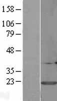 CALM3 / Calmodulin 3 Protein - Western validation with an anti-DDK antibody * L: Control HEK293 lysate R: Over-expression lysate