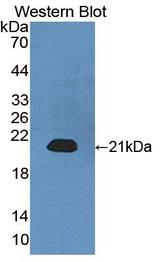 CALML3 Antibody - Western blot of CALML3 antibody.