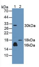 CALML3 Antibody - Western Blot; Sample: Lane1: Human A431 Cells; Lane2: Rat Skin Tissue.