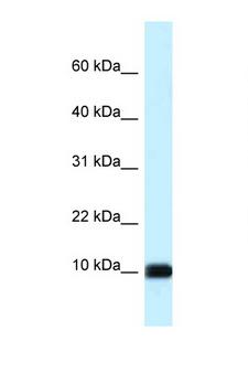CALML3 Antibody - CALML3 antibody Western blot of HeLa Cell lysate. Antibody concentration 1 ug/ml.  This image was taken for the unconjugated form of this product. Other forms have not been tested.