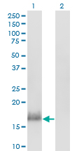 CALML3 Antibody - Western blot of CALML3 expression in transfected 293T cell line by CALML3 monoclonal antibody (M04), clone 2A11.