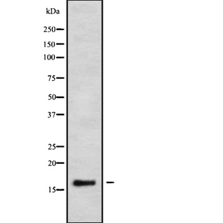CALML3 Antibody - Western blot analysis of CALML3 using K562 whole cells lysates