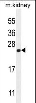 CALML4 Antibody - CALML4 Antibody western blot of mouse kidney tissue lysates (35 ug/lane). The CALML4 antibody detected the CALML4 protein (arrow).