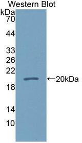 CALML5 Antibody - Western blot of CALML5 antibody.