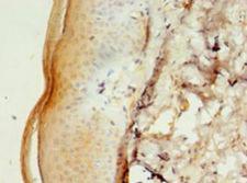 CALML5 Antibody - Immunohistochemistry of paraffin-embedded human skin tissue using antibody at 1:100 dilution.  This image was taken for the unconjugated form of this product. Other forms have not been tested.