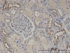 CALML5 Antibody - Immunoperoxidase of monoclonal antibody to CALML5 on formalin-fixed paraffin-embedded human kidney. [antibody concentration 3 ug/ml]