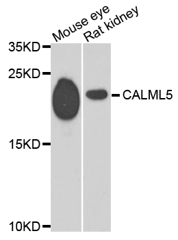 CALML5 Antibody - Western blot analysis of extracts of mouse eye and rat kidney.