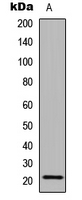 CALML6 Antibody - Western blot analysis of CALML6 expression in MCF7 (A) whole cell lysates.