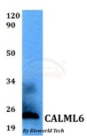 CALML6 Antibody - Western blot of CALML6 antibody at 1:500 dilution. Lane 1: MCF-7 whole cell lysate.