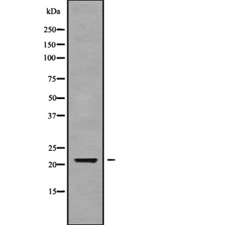 CALML6 Antibody - Western blot analysis of CALML6 using Jurkat whole cells lysates