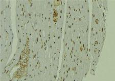 CALML6 Antibody - 1:100 staining mouse muscle tissue by IHC-P. The sample was formaldehyde fixed and a heat mediated antigen retrieval step in citrate buffer was performed. The sample was then blocked and incubated with the antibody for 1.5 hours at 22°C. An HRP conjugated goat anti-rabbit antibody was used as the secondary.