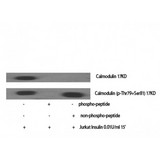 Calmodulin Antibody - Western blot of Phospho-Calmodulin (T80/S82) antibody