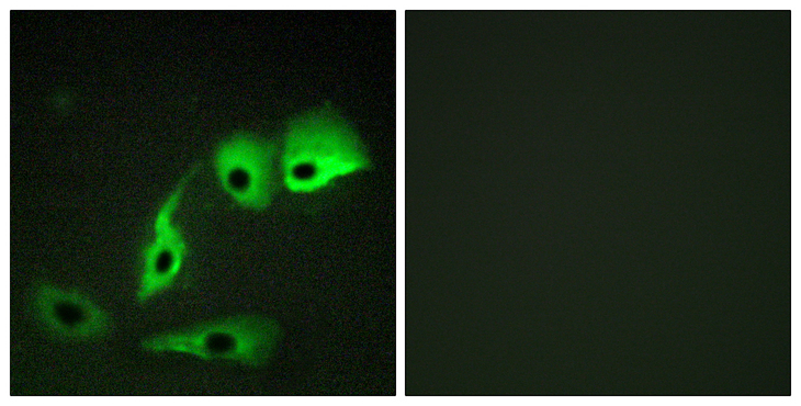 Calmodulin Antibody - Immunofluorescence analysis of HepG2 cells, using Calmodulin Antibody. The picture on the right is blocked with the synthesized peptide.