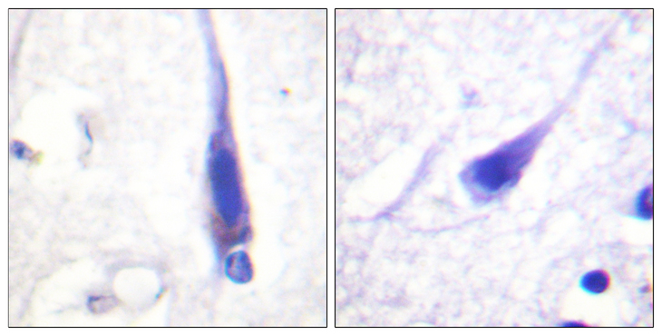 Calmodulin Antibody - Immunohistochemistry analysis of paraffin-embedded human brain tissue, using Calmodulin Antibody. The picture on the right is blocked with the synthesized peptide.