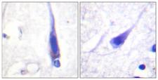Calmodulin Antibody - Immunohistochemistry analysis of paraffin-embedded human brain tissue, using Calmodulin Antibody. The picture on the right is blocked with the synthesized peptide.