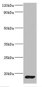 Calmodulin Antibody - Western blot All lanes: Calmodulin antibody at 2µg/ml + Mouse skeletal muscle tissue Secondary Goat polyclonal to rabbit IgG at 1/10000 dilution Predicted band size: 17 kDa Observed band size: 17 kDa