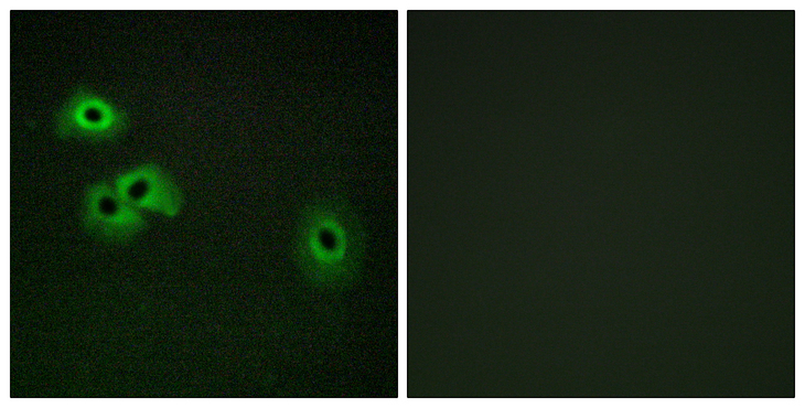 Calmodulin Antibody - Immunofluorescence analysis of HepG2 cells, using Calmodulin (Phospho-Thr79+Ser81) Antibody. The picture on the right is blocked with the phospho peptide.