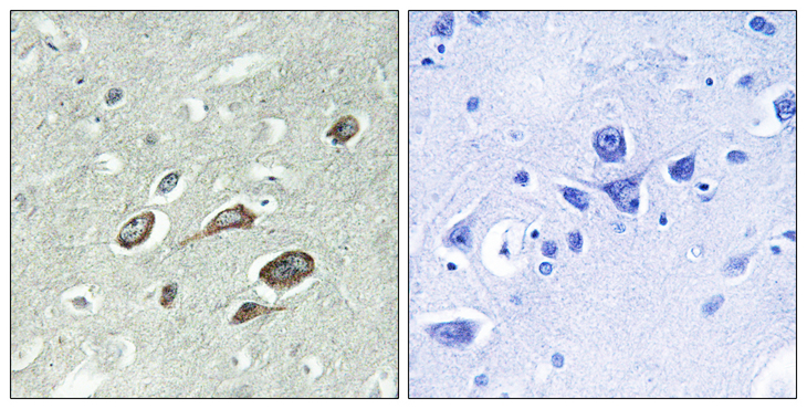 Calmodulin Antibody - Immunohistochemistry analysis of paraffin-embedded human brain, using Calmodulin (Phospho-Thr79+Ser81) Antibody. The picture on the right is blocked with the phospho peptide.