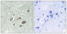 Calmodulin Antibody - Immunohistochemistry analysis of paraffin-embedded human brain, using Calmodulin (Phospho-Thr79+Ser81) Antibody. The picture on the right is blocked with the phospho peptide.