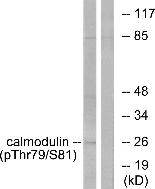 Calmodulin Antibody - Western blot analysis of lysates from Jurkat cells treated with Insulin 0.01U/ml 15', using Calmodulin (Phospho-Thr79+Ser81) Antibody. The lane on the right is blocked with the phospho peptide.