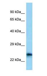 Calneuron-1 / CALN1 Antibody - Calneuron-1 / CALN1 antibody Western Blot of COLO205.  This image was taken for the unconjugated form of this product. Other forms have not been tested.