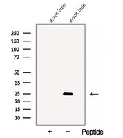 Calneuron-1 / CALN1 Antibody - Western blot analysis of extracts of mouse brain tissue using CALN1 antibody. The lane on the left was treated with blocking peptide.