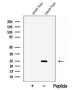 Calneuron-1 / CALN1 Antibody - Western blot analysis of extracts of mouse brain tissue using CALN1 antibody. The lane on the left was treated with blocking peptide.