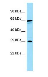 Calneuron-1 / CALN1 Antibody - Calneuron-1 / CALN1 antibody Western Blot of COLO205.  This image was taken for the unconjugated form of this product. Other forms have not been tested.