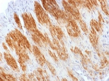 Calponin Antibody - IHC testing of FFPE rat uterus stained with Calponin antibody. HIER: steam sections in 10mM Tris with 1mM EDTA, pH 9.0, for 10-20 min.