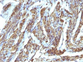 Calponin Antibody - IHC testing of FFPE human uterus stained with Calponin antibody. HIER: steam sections in 10mM Tris with 1mM EDTA, pH 9.0, for 10-20 min.