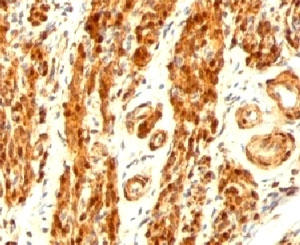 Calponin Antibody - Formalin-fixed, paraffin-embedded human uterus stained with anti-Calponin antibody (CNN1/832).  This image was taken for the unmodified form of this product. Other forms have not been tested.