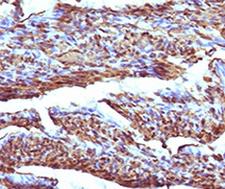 Calponin Antibody -  This image was taken for the unmodified form of this product. Other forms have not been tested.