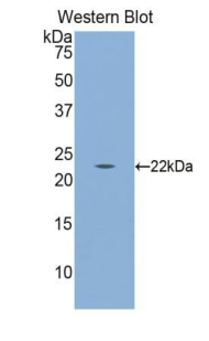 CALR / Calreticulin Antibody - Western blot of recombinant CALR / Calreticulin.  This image was taken for the unconjugated form of this product. Other forms have not been tested.