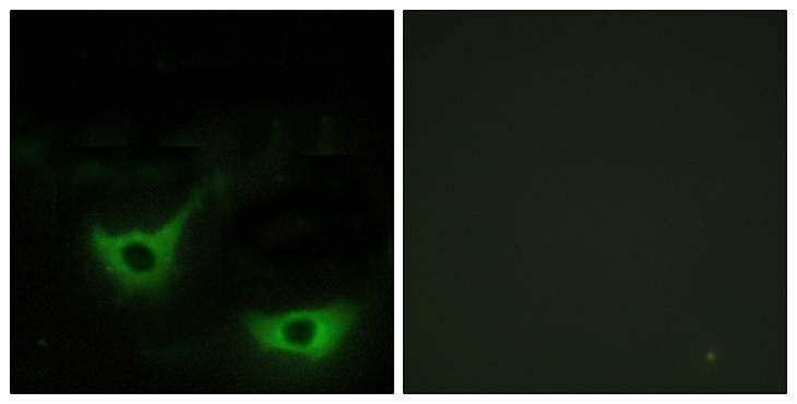 CALR / Calreticulin Antibody - Immunofluorescence analysis of NIH/3T3 cells, using CALR Antibody. The picture on the right is blocked with the synthesized peptide.