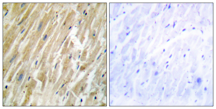 CALR / Calreticulin Antibody - Immunohistochemistry analysis of paraffin-embedded human heart tissue, using CALR Antibody. The picture on the right is blocked with the synthesized peptide.