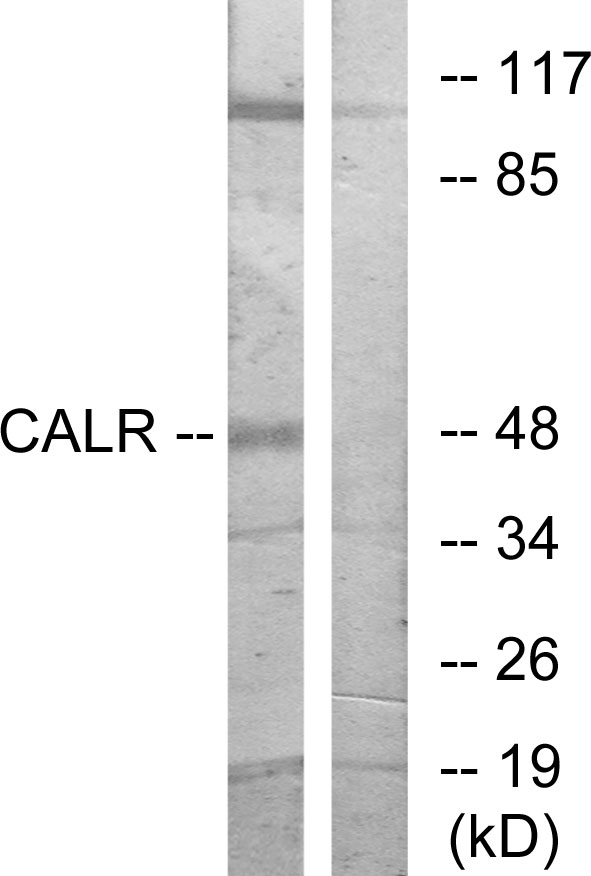 CALR / Calreticulin Antibody - Western blot analysis of lysates from COS7 cells, using CALR Antibody. The lane on the right is blocked with the synthesized peptide.