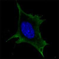 CALR / Calreticulin Antibody - Immunocytochemistry/Immunofluorescence: Calreticulin Antibody (1G6A7) - Confocal immunofluorescence analysis of 3T3-L1 cells using anti-Calreticulin mAb (green). Blue: DRAQ5 fluorescent DNA dye.