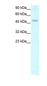 CALR / Calreticulin Antibody - CALR / Calreticulin antibody ARP30113_T100-NP_004334-CALR (calreticulin) Antibody Western blot of Daudi lysate.  This image was taken for the unconjugated form of this product. Other forms have not been tested.