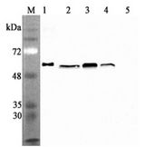 CALR / Calreticulin Antibody - Western blot analysis using anti-Calreticulin (human), mAb (CR213-2AG) at 1:2000 dilution. 1: Human Calreticulin (His-tagged). 2: HEK 293T cell lysates (100 ug). 3: HepG2 cell lysates (100 ug). 4: THP1 cell lysates (100 ug). 5: Human FTO (His-tagged) (negative control).