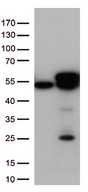 CALR / Calreticulin Antibody - HEK293T cells were transfected with the pCMV6-ENTRY control. (Left lane) or pCMV6-ENTRY CALR. (Right lane) cDNA for 48 hrs and lysed. Equivalent amounts of cell lysates. (5 ug per lane) were separated by SDS-PAGE and immunoblotted with anti-CALR. (1:500)