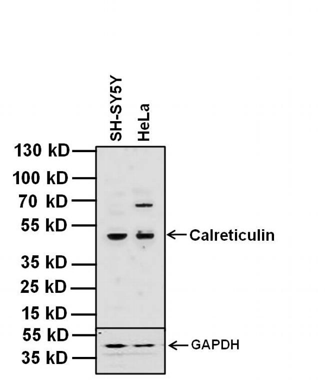 CALR / Calreticulin Antibody - Calreticulin Antibody in Western Blot (WB)