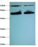 CALR / Calreticulin Antibody - Western blot of Calreticulin antibody at 2 ug/ml. Lane 1: EC109 whole cell lysate. Lane 2: 293T whole cell lysate . Secondary: Goat polyclonal to Rabbit IgG at 1:15000 dilution . Predicted band size: 42 kDa . Observed band size: 70 kDa Additional bands at: 118 kDa. We are unsure as to the identity of these extra bands.  This image was taken for the unconjugated form of this product. Other forms have not been tested.