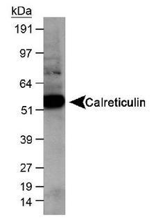 CALR / Calreticulin Antibody - Detection of calreticulin in human kidney lysate at 1:1000. ECL exposure, 10 seconds.