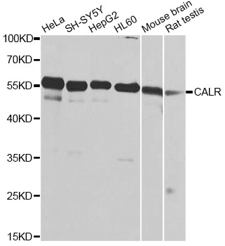 CALR / Calreticulin Antibody - Western blot analysis of extracts of various cell lines, using CALR antibody at 1:1000 dilution. The secondary antibody used was an HRP Goat Anti-Rabbit IgG (H+L) at 1:10000 dilution. Lysates were loaded 25ug per lane and 3% nonfat dry milk in TBST was used for blocking. An ECL Kit was used for detection and the exposure time was 1s.