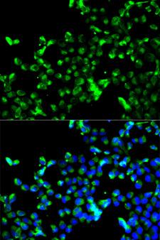CALR / Calreticulin Antibody - Immunofluorescence analysis of HeLa cells using CALR antibody. Blue: DAPI for nuclear staining.